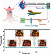 科学家研发可植入式自驱动能源系统为心脏起搏器充电